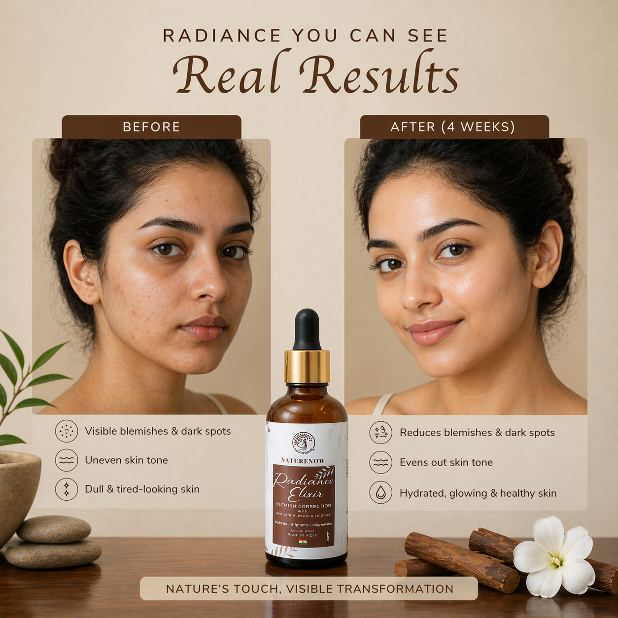 Radiance Elixir  Blemish Correction Face Serum