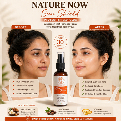 Sun Shield Sunscreen SPF 30